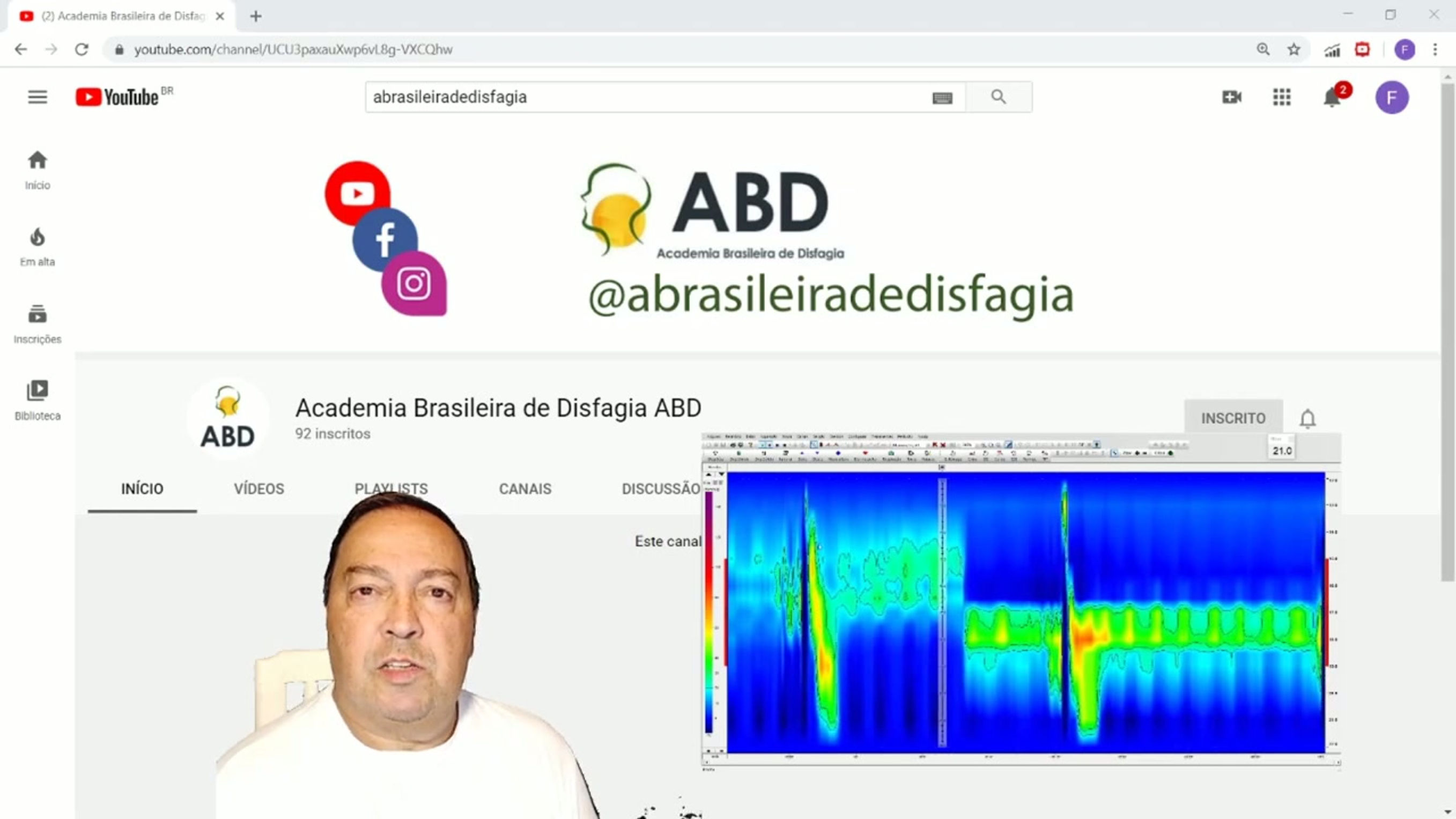 Manometria Esofágica de Alta Resolução e Disfagia